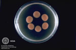 Cryptococcus neoformans